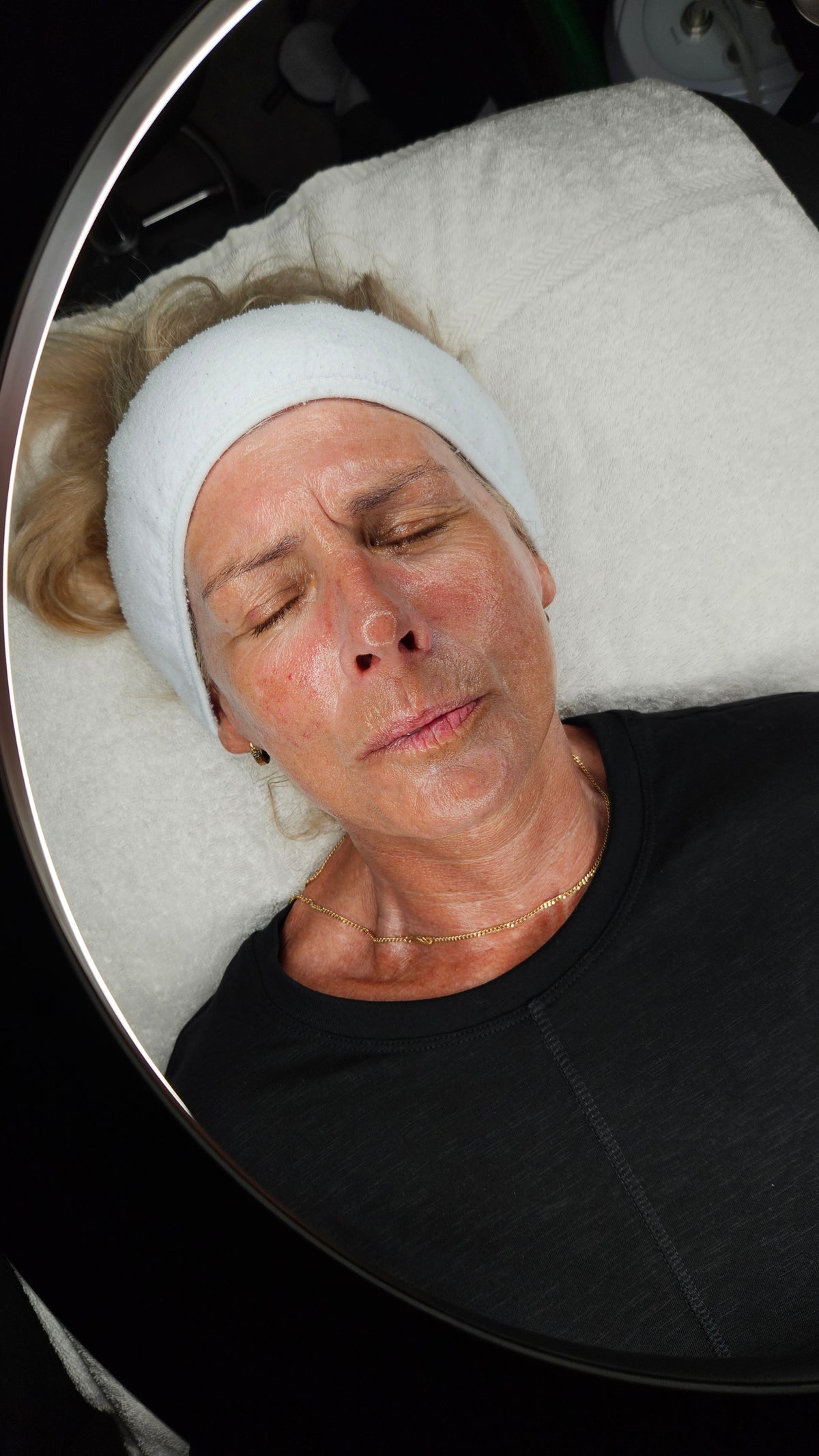 HEXIE Beauty client treatment result