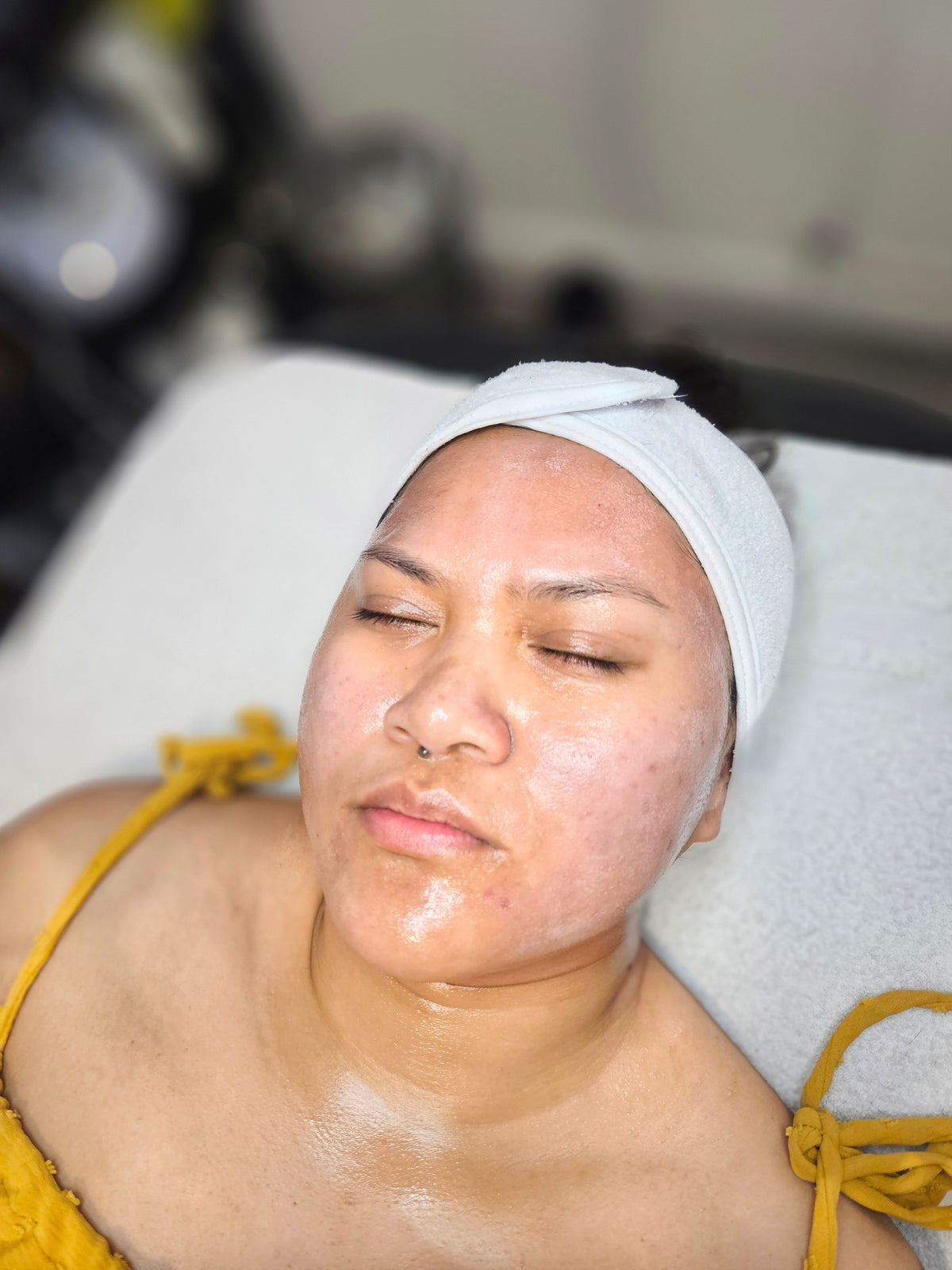 HEXIE Beauty client treatment result