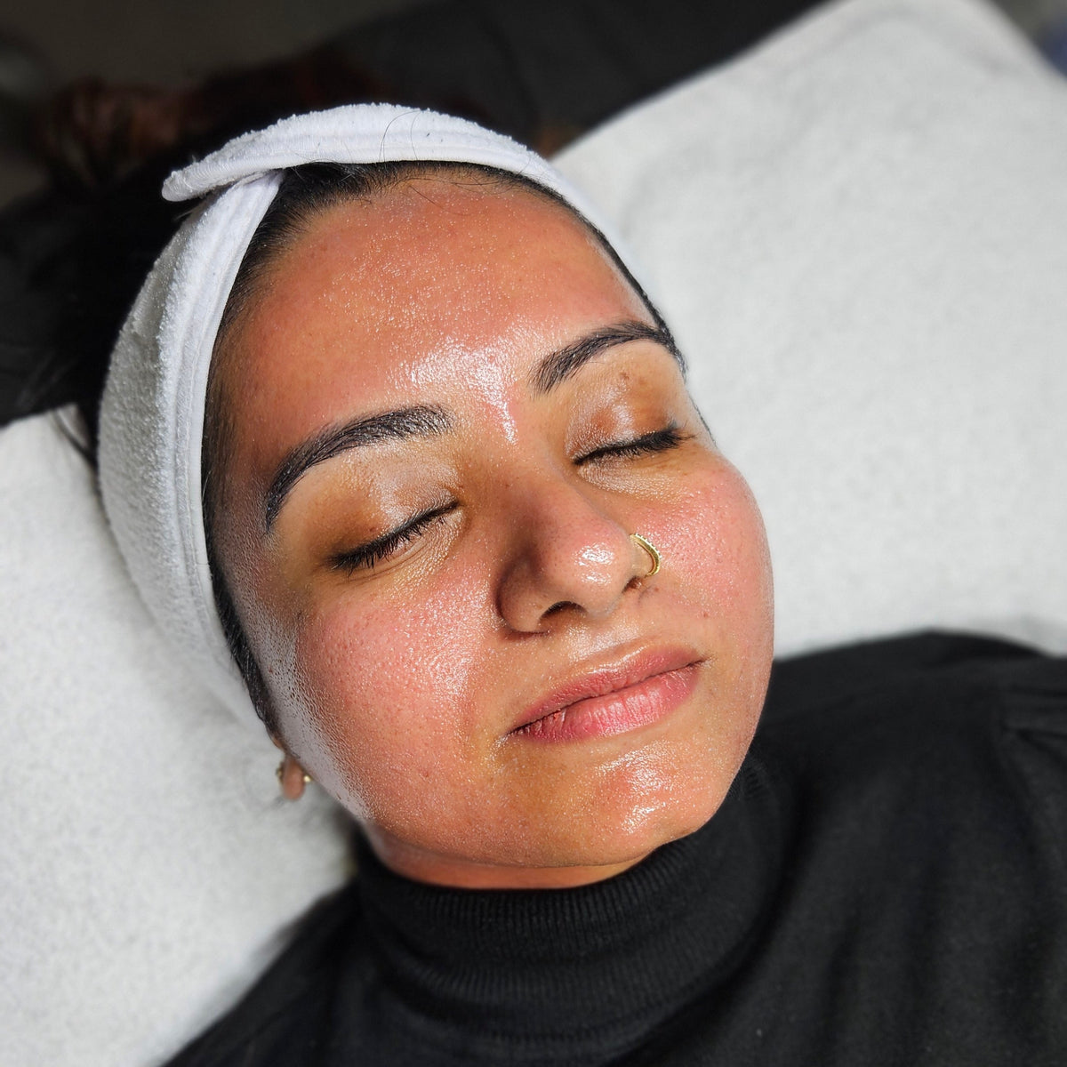 HEXIE Beauty client treatment result