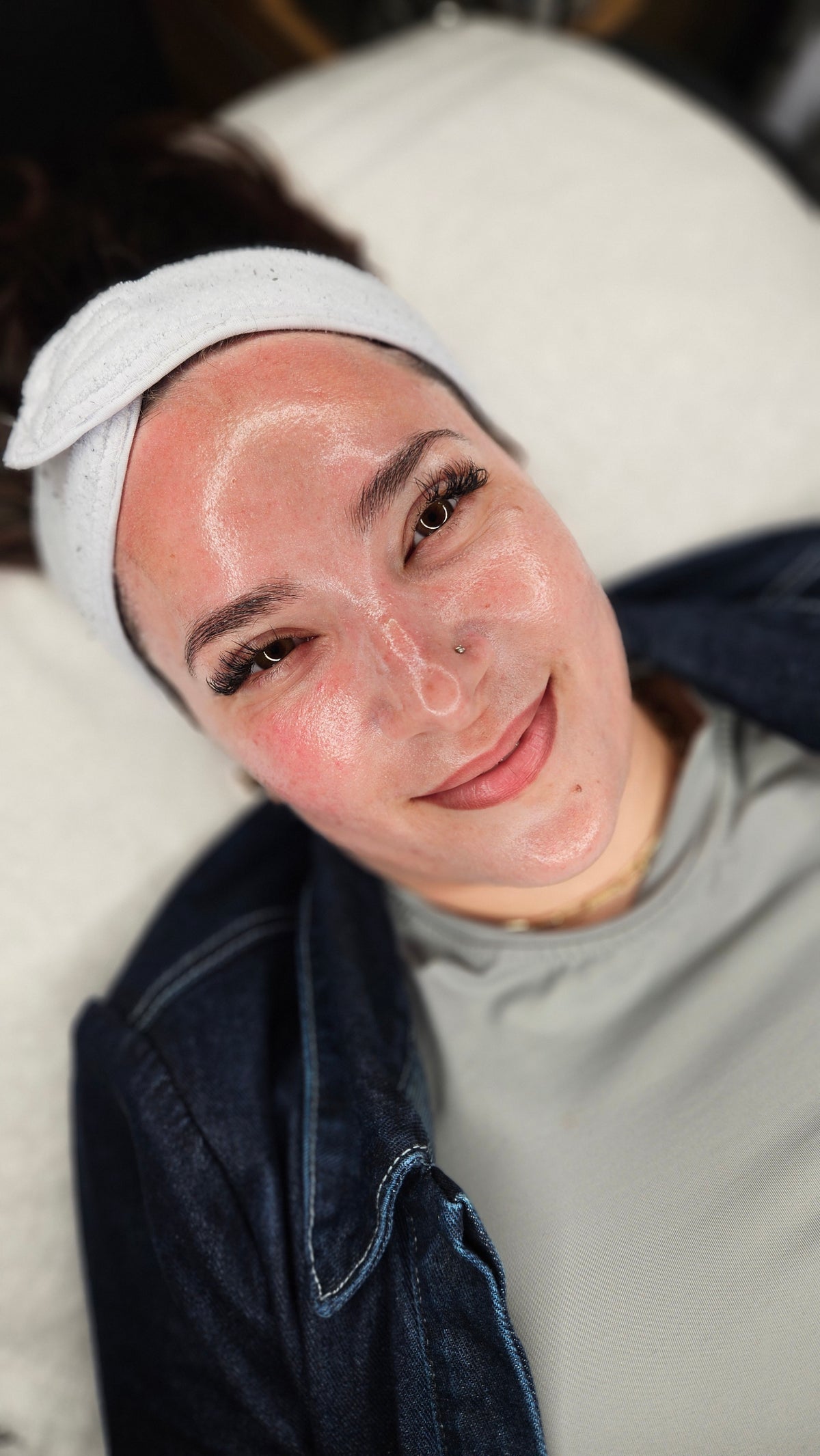 HEXIE Beauty client treatment result