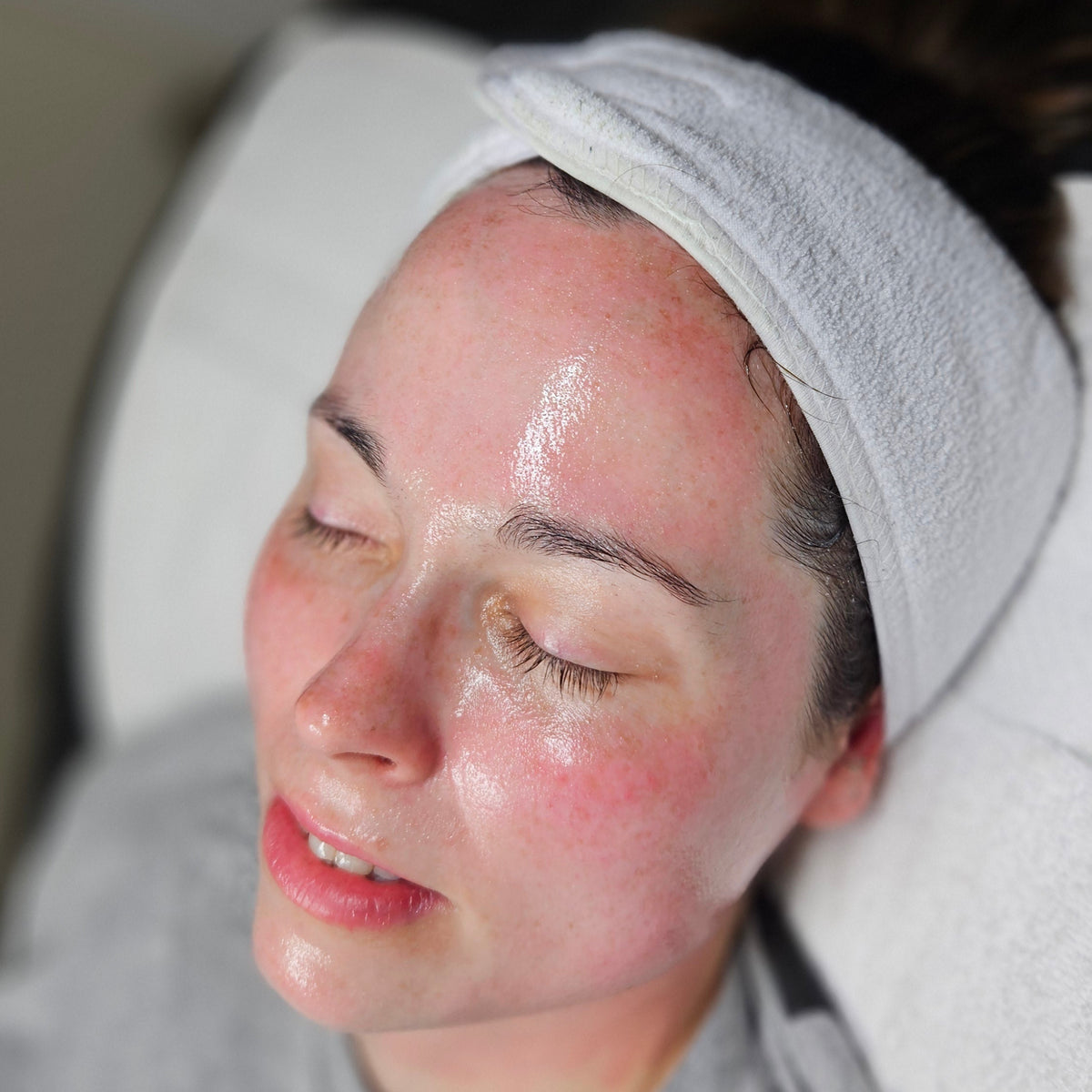 HEXIE Beauty client treatment result