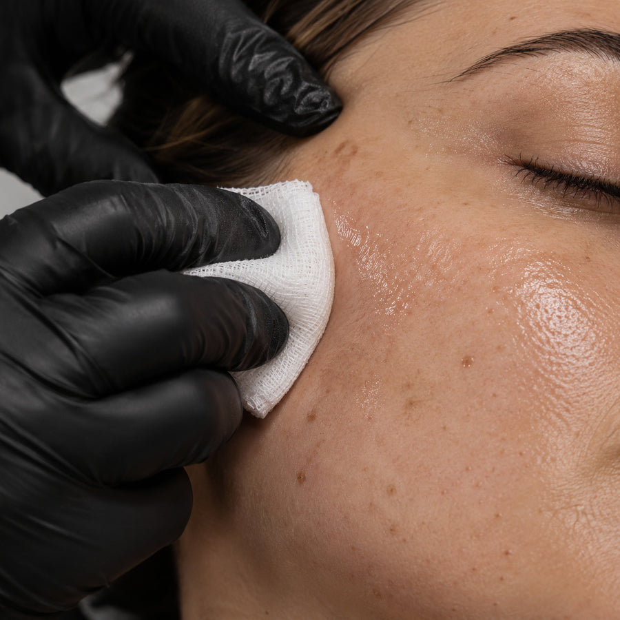 Skin Peel